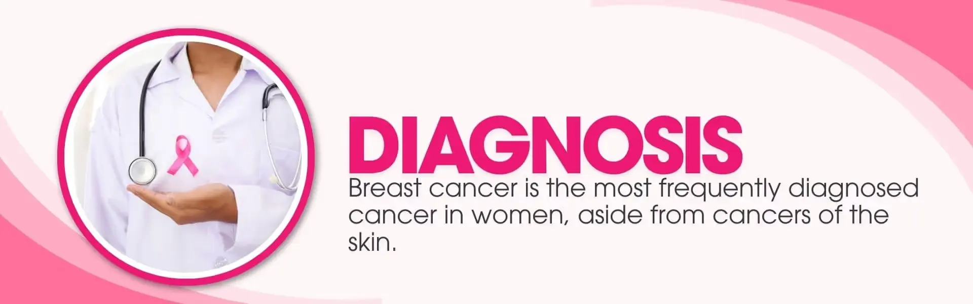 Breast cancer is the most frequently diagnosed cancer in women, aside from cancres of the skin